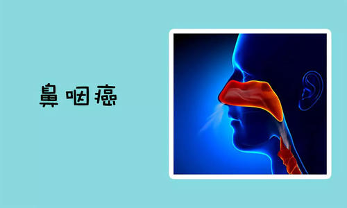 杭州御和堂老中医讲解：中医治疗鼻咽癌的方法